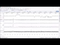 Download Lagu Quick Guide to Sleep Staging and Scoring using Noxturnal