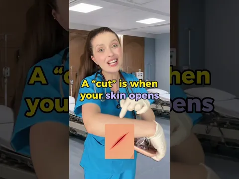 A cat accident 🐈‍⬛ #englishtips #learnenglish