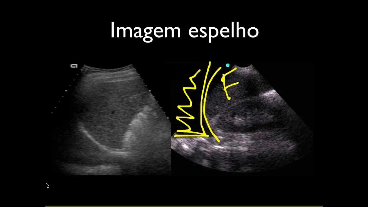 Introdução ao Ultrassom – Prof. Ana Claudia Tonelli.