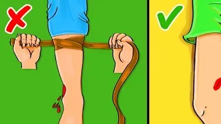 10 أخطاء في الإسعافات الأولية يشرحها الخبراء 