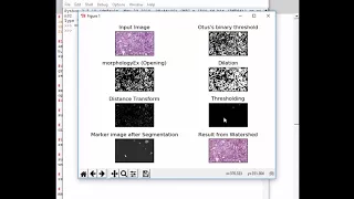 Watershed Algorithm