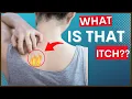 Download Lagu Notalgia Paresthetica (“Itchy Back”) \u0026 Causes, Symptoms, \u0026 Tips For Treatment