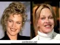 Melanie Griffith plastic surgery