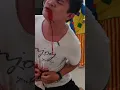 Download Lagu Arfandi Moko sudah mati sama badut 😭😭😭