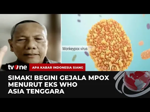 Waspada! Mpox Masuk Indonesia, Ini Penjelasan Eks WHO Asia Tenggara