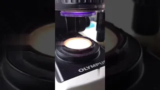 Vigina Discharge Under The Microscope 