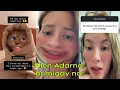 Ellen Adarna nagsalita na kung ano at sino ang dahilan ng hiwalayan nila ni Derek Ramsay Omg