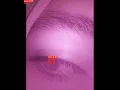 Human Eye Pupil Tracking in using YOLOv8 Segmentation model