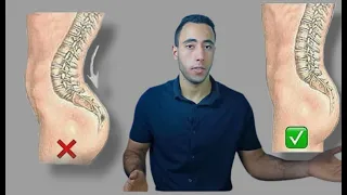 علاج تقوس أسفل الظهر بروز المؤخرة د محمد عبدالله 