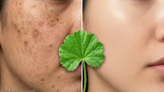 a true treasure from nature how can you brighten your skin and remove wrinkles with this plant 