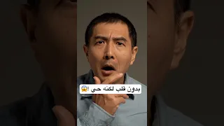 هل تصدق أن إنسان عاش بدون قلب بين العقل والجنون حقائق 