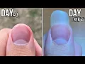 Lagu 100 Days Of Fingernail Growth - Time Lapse