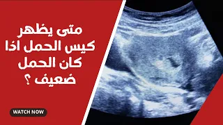 متى يظهر كيس الحمل اذا كان الحمل ضعيف ؟