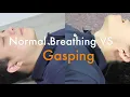 Sudden Cardiac Arrest SCA and Agonal Breathing Gasping