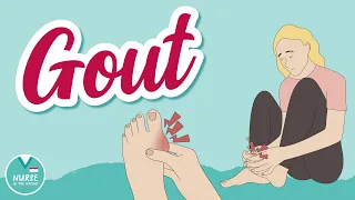All About Gout NCLEX Review for Med Surg Nursing