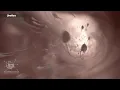 Download Lagu Male Reproductive System|3d medical animation|#malereproductivesystem #sperm  #erectiledysfunction