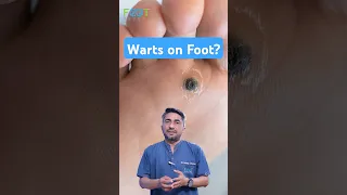 Causes of foot warts Plantar warts
