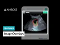 AMBOSS Features Overlay