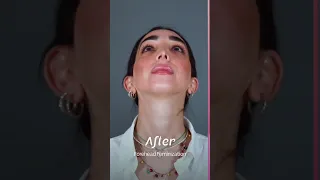 Lola beautiful post-op results of her