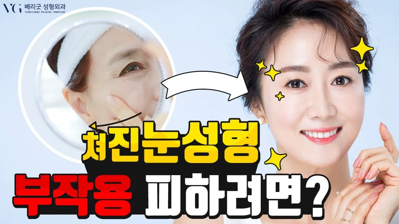 #임영민원장 #베리굿성형외과 처진 눈성형 부작용 피하려면❓❓❓