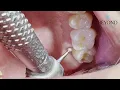 What Happens at an Emergency Dental Appointment Urgent Care Dentistry