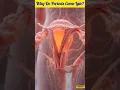 Why Do Periods Come Late Causes of Irregular Menstrual Cycle Explained