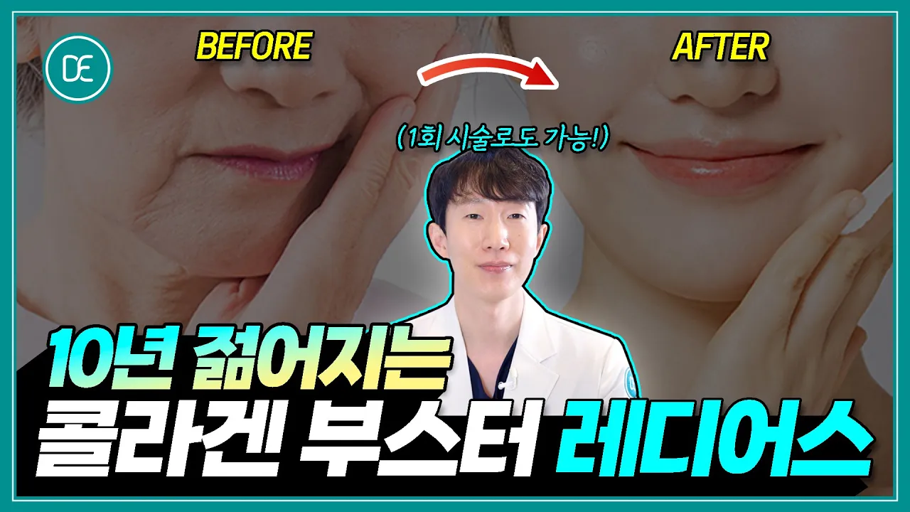콜라겐부스터 최강자 레디어스 | 10년 어려지는 시술