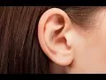Home Remedies to Deal with a Pimple in Ear