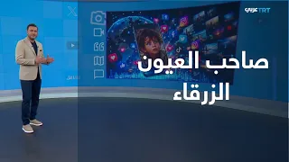 تفاعل | عيونه الزرقاء حولته من بائع متجول لأشهر طفل باليمن