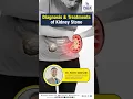 Kidney Stones Disease - Diagnosis Treatment Kidney Stone Diagnosis Kidney Stone Treatments