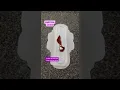 Download Lagu Is your period bleeding normal? Is it implantation bleeding or ovulation spotting?  #menstrualcycle