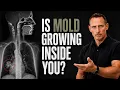 Mold Toxicity Why You re Still Sick After Leaving the Mold
