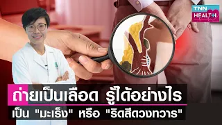 ริสีดวงทวารเกิดจากสาเหตุอะไรบ้าง