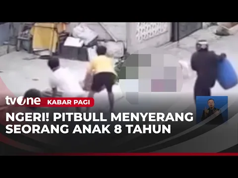 Detik-detik Seekor Anjing Pitbull Gigit Bocah Perempuan 8 Tahun