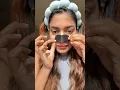 Download Lagu Tried The Viral Furr Charcoal Nose strips for the first time #skincare #viralvideo #shorts #fyp