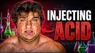 He Injected Acid Into His Face and Aged 10 Years in 12 Months