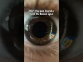 Download Lagu My Eyeball Close Up Freaks Me Out For Some Reason #Shorts