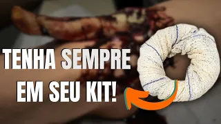 Dica INFALÍVEL para Imobilização de Fratura Exposta que os Especialistas NÃO Querem que Você Saiba!