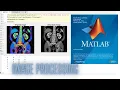 Image Processing RGB To Gray Scale Image Conversion In MATLAB