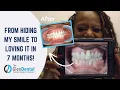 One year ago I walked into Willow Glen Dental and today I m walking out with a smile I love