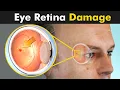 Download Lagu Retinitis Pigmentosa : Damage To Retina Of The Eye | Symptoms, Causes And Treatment