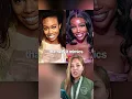 SZA Before After Plastic Surgery