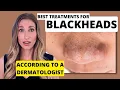 Blackheads Dermatologist Shares Best Treatments to Remove Them with Affordable Skincare Options