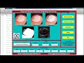 Fingernail Disease Detection Using Image Processing Source Code Fingernail Disease Detect MatlabCode