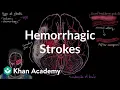 Hemorrhagic strokes Circulatory System and Disease NCLEX-RN Khan Academy