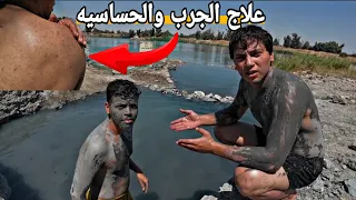 دخلت عيون كبريتية تعالج الأمراض الجلدية في الموصل _مكان عجيب😱😱
