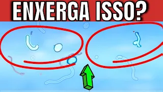 Por que você enxerga SUJEIRINHAS flutuando nos olhos? | Como ACABAR com elas (naturalmente)?