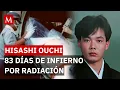 The tragic story of Hisashi Ouchi the man who suffered the largest radioactive exposure in history