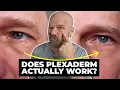 Download Lagu Old Dude Tries Plexaderm! Plexaderm vs Sudden Change.