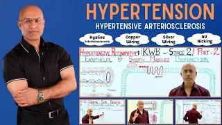 Hypertension | Hypertensive Arteriosclerosis